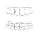 Healthy teeth sketch. Tooth braces outline doodle icon. Dentistry, stomatology and dental care concept.