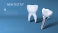 Healthy Tooth And Dental Implant Clinic Ad Royalty Free Stock Photo
