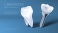 Healthy Tooth And Dental Implant Clinic Ad Royalty Free Stock Photo