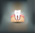 Healthy tooth, gums and bone Royalty Free Stock Photo