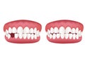 Healthy tooth model