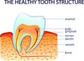 THE HEALTHY TOOTH STRUCTURE Royalty Free Stock Photo