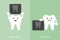 Healthy tooth and tooth decay holding dental x-ray film Royalty Free Stock Photo