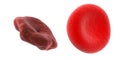 healthy and unhealthy blood cell