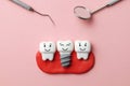 Healthy white teeth and implants are smiling on pink background and dentist tools mirror, hook.