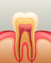 Healthy white tooth, gums and bone Royalty Free Stock Photo