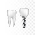 Healthy white tooth and implant with steel screw. Dentistry and dentist care. Vector illustration isolated on transparent