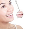 Healthy woman teeth and a dentist mouth mirror Royalty Free Stock Photo