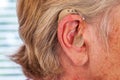 Hearing aid in the ear