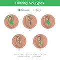 Hearing Aid Types. Health care products.