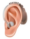 Hearing aid. Sound amplifier for patients with hearing loss. Medicine and health. Realistic object behind the ear