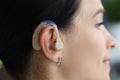 Hearing aid is on woman ear closeup Royalty Free Stock Photo