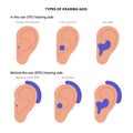 Hearing aids types