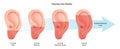 Hearing loss stages. Medical diagnosis of hearing system disease