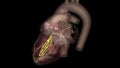 Heart, anterior fascicle