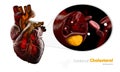 Heart as example, Blocked blood vessel, artery with cholesterol buildup, Illustration isolated white