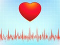 Heart attack electrocardiogram-ecg. EPS 8