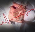 Heart attack and heart beats cardiogram Royalty Free Stock Photo