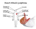 Heart Attack Symptoms Royalty Free Stock Photo