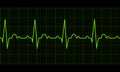 Heart beat. Cardiogram. Cardiac cycle