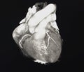 Heart Computed Tomography Royalty Free Stock Photo