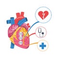 heart condition to infarction prevention