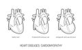 Heart diseases concept in flat style, vector Royalty Free Stock Photo