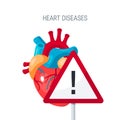 Heart diseases vector concept in flat style Royalty Free Stock Photo