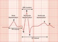 Heart ECG Royalty Free Stock Photo