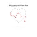 Schematic Electrocardiogram of miocardial infaction.