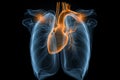 Heart and lung x-ray, heart attack, Myocarditis disease, inflammation of the muscle, thrombosis and cardiac stress, human organ