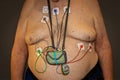 Heart monitor with sensors taped to overweight senior male torso against dark background Royalty Free Stock Photo