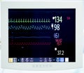 Heart monitor during surgery Royalty Free Stock Photo