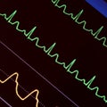 Heart monitoring in emergency care