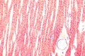 Heart muscle, light micrograph Royalty Free Stock Photo