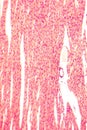 Heart muscle, light micrograph Royalty Free Stock Photo