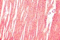 Heart muscle, light micrograph Royalty Free Stock Photo