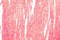 Heart muscle, light micrograph Royalty Free Stock Photo