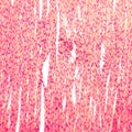 Heart muscle, light micrograph