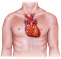 Heart - Overlaid on Male Torso, Inflamed Royalty Free Stock Photo