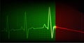 Cardiac arrest and heart beating again. Heart rate graph. Ekg icon wave.