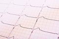 Heart rhythm chart