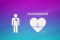 Heart shape with echocardiogram and PACEMAKER text. Cardiology concept Royalty Free Stock Photo