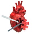 Heart surgery concept, 3D