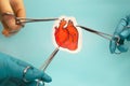 Heart surgery. Medical instruments and drawing of heart on blue background. Royalty Free Stock Photo