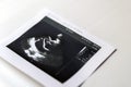 Heart ultrasound image print on paper Royalty Free Stock Photo