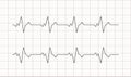 Heartbeat ecg electrocardiogram vector graph wave line. Ekg cardio heart beat cardiology frequency monitor Royalty Free Stock Photo