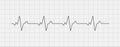 Heartbeat ecg electrocardiogram vector graph wave line. Ekg cardio heart beat cardiology frequency monitor Royalty Free Stock Photo