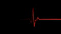 Heartbeat flatline. Red heartbeat line on EKG screen