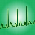 Battito cardiaco verde 
